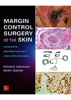 Margin Control Surgery of the Skin: Concepts, Histopathology, and Applications 1st Edicion 2023 | جراحی کنترل حاشیه پوست: مفاهیم، هیستوپاتولوژی و کاربردها نسخه اول
