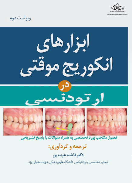 ابزارهای انکوریج موقتی در ارتودنسی
