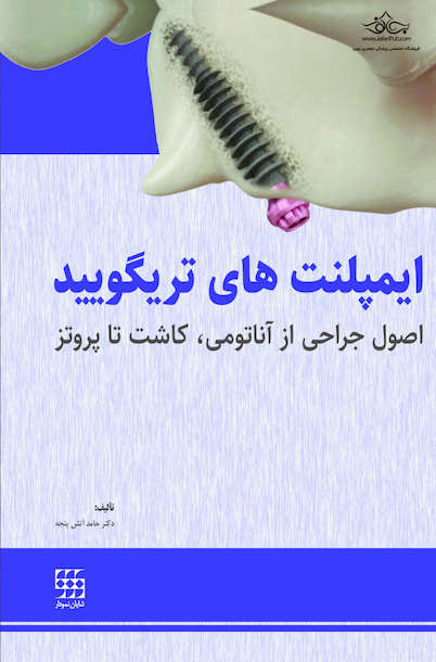 ایمپلنت های تریگویید اصول جراحی از آناتومی، کاشت تا پروتز