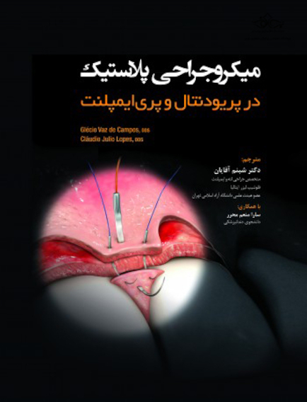 میکروجراحی پلاستیک در پریودنتال و پری ایمپلنت تکنیکهای کم تهاجمی با حداکثر دقت
