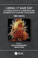 Cardiac CT Made Easy: An Introduction to Cardiovascular Multidetector Computed Tomography 3rd Edition | سی تی قلب آسان ساخته شده: مقدمه ای بر توموگرافی کامپیوتری چند آشکارساز قلبی ویرایش سوم