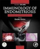 Immunology of Endometriosis: Pathogenesis and Management (Reproductive Immunology) | ایمونولوژی اندومتریوز: پاتوژنز و مدیریت (ایمونولوژی تولید مثل)