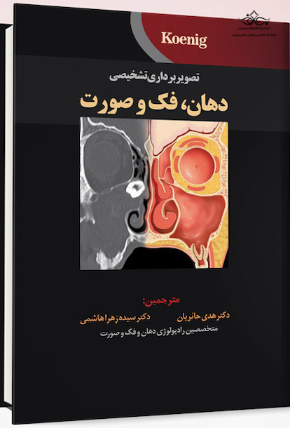 تصویربرداری تشخیصی دهان، فک و صورت  koenig