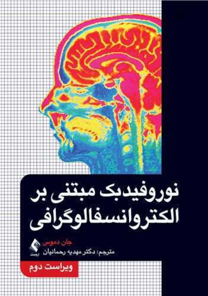 نوروفیدبک مبتنی بر الکتروانسفالوگرافی