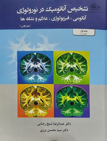 تشخیص آناتومیک در نورولوژی  آناتومی ، فیزیولوژی ، علائم ، نشانه ها
