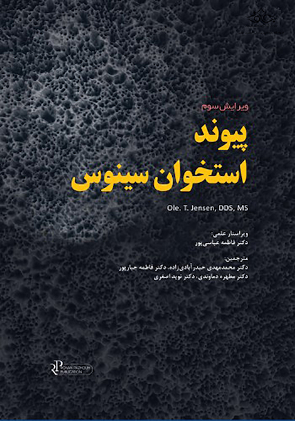 پیوند استخوان سینوس 2019