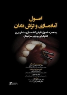 اصول آماده سازی و تراش دندان