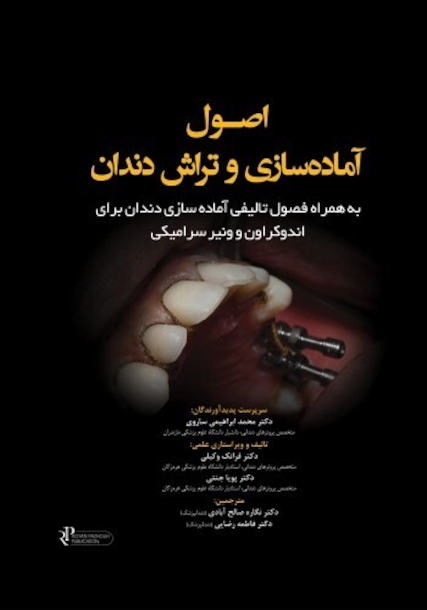 اصول آماده سازی و تراش دندان