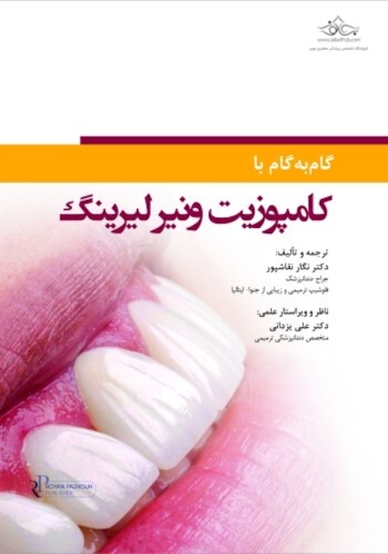 گام به گام با کامپوزیت ونیر لیرینگ