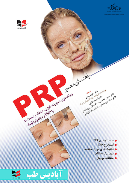 راهنمای مصور PRP