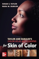 Taylor and Elbuluk's Color Atlas and Synopsis for Skin of Color | اطلس رنگ تیلور و البولوک و خلاصه برای پوست رنگ
