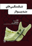 شکستگی های مندیبولار