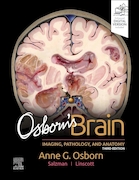 Osborn's Brain 3rd Edition | مغز آزبورن ویرایش سوم