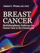 Breast Cancer Multidisciplinary Pathways for Cancer Care in the Community | سرطان سینه: مسیرهای چند رشته ای برای مراقبت از سرطان در جامعه