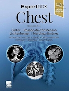 ExpertDDx: Chest 2nd Edition | کارشناس DDx:سینه ویرایش دوم