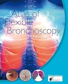 Atlas of Flexible Bronchoscopy 1st Edition | اطلس برونکوسکوپی انعطاف پذیر چاپ اول