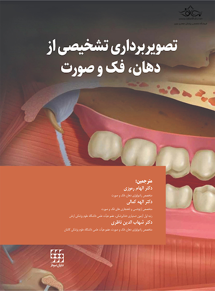 تصویربرداری تشخیصی از دهان، فک و صورت