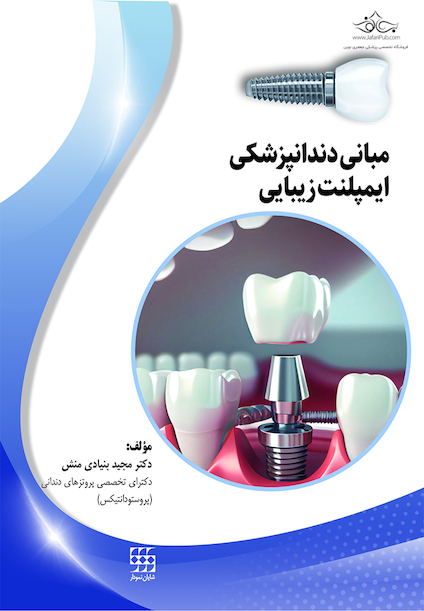 مبانی دندانپزشکی ایمپلنت زیبایی