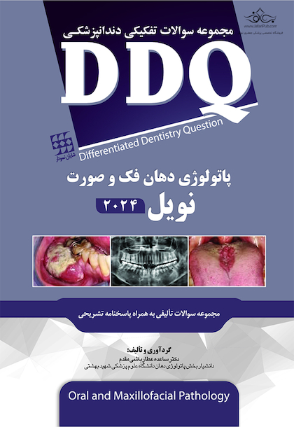 DDQ مجموعه سوالات تفکیکی دندانپزشکی پاتولوژی دهان، فک و صورت نویل 2024