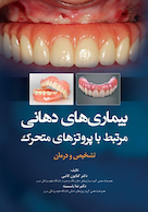 بیماریهای دهانی مرتبط با پروتزهای متحرک تشخیص و درمان
