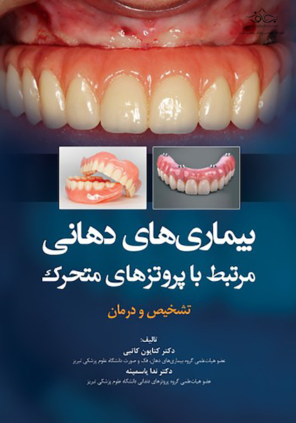 بیماریهای دهانی مرتبط با پروتزهای متحرک تشخیص و درمان