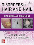 Disorders of the Hair and Nail: Diagnosis and Treatment 1st Edition | اختلالات مو و ناخن: تشخیص و درمان ویرایش اول