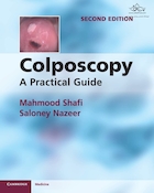 Colposcopy: A Practical Guide 2nd Edition | کولپوسکوپی: راهنمای عملی ویرایش دوم