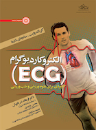 الکتروکاردیوگرام (ECG) | الکتروکاردیوگرام (ECG)