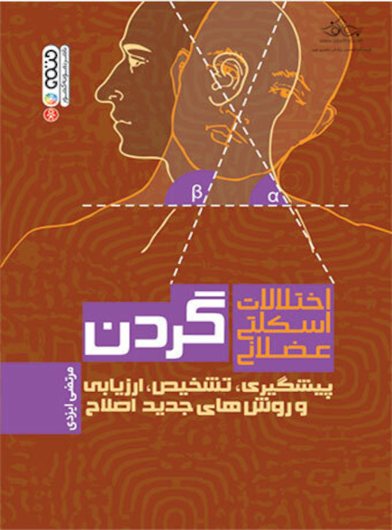 اختلالات اسکلتی عضلانی گردن