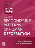 Smith's Recognizable Patterns of Human Deformation 5th Edition | الگوهای قابل تشخیص تغییر شکل انسان توسط اسمیت ویرایش پنجم