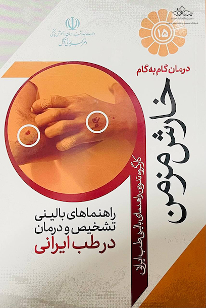 درمان گام به گام خارش مزمن