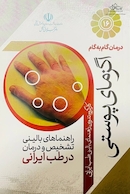 درمان گام به گام اگزمای پوستی