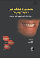 ساکشن پروتز کامل فک پایین به صورت پیشرفته