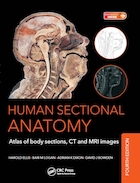 Human Sectional Anatomy: Atlas of Body Sections, CT and MRI Images, 4th Edition 2015 | آناتومی مقطعی انسان: اطلس بخش های بدن، تصاویر سی تی و ام آر آی، ویرایش چهارم