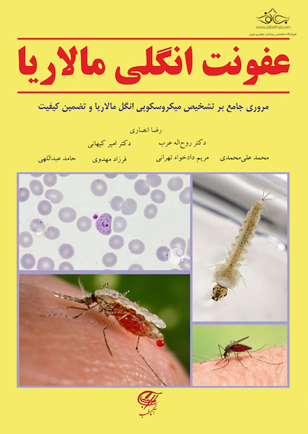 عفونت انگلی مالاریا