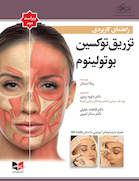 راهنمای کاربردی تزریق توکسین بوتولینوم 2024