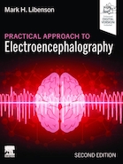 Practical Approach to Electroencephalography 2nd Edition 2025 | رویکرد عملی به الکتروانسفالوگرافی ویرایش دوم