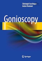 Gonioscopy 2012th Edition | گونیوسکوپی نسخه 2012