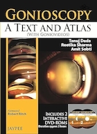 Gonioscopy: A Text and Atlas 1st Edition | گونیوسکوپی: متن و اطلس ویرایش اول