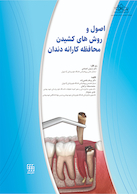 اصول و روش های کشیدن محافظه کارانه دندان