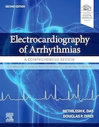 Electrocardiography of Arrhythmias: A Comprehensive Review: A Companion to Cardiac Electrophysiology 2nd Edition | الکتروکاردیوگرافی آریتمی ها: مروری جامع: همراهی با الکتروفیزیولوژی قلب ویرایش دوم