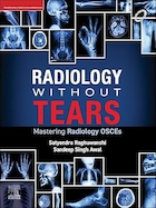 Radiology Without Tears: Mastering Radiology OSCEs | رادیولوژی بدون اشک: تسلط بر رادیولوژی OSCE