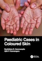 Paediatric Cases in Coloured Skin 1st Edition | موارد کودکان در پوست رنگی نسخه 1