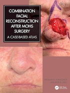Combination Facial Reconstruction after Mohs Surgery: A Case Based Atlas 1st Edition | بازسازی صورت ترکیبی بعد از جراحی موس:اطلس مبتنی بر پرونده نسخه اول