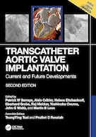 Transcatheter Aortic Valve Implantation: Current and Future Developments 2nd Edition | کاشت دریچه آئورت ترانس کاتتر: تحولات فعلی و آینده نسخه دوم