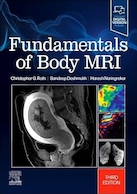 Fundamentals of Body MRI (Fundamentals of Radiology) 3rd Edition | مبانی ام آر آی بدن (مبانی رادیولوژی)ویرایش سوم