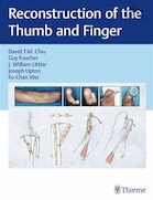Reconstruction of the Thumb and Finger | بازسازی انگشت شست و انگشت