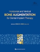 Horizontal and Vertical Bone Augmentation for Dental Implant Therapy | افزایش افقی و عمودی استخوان برای درمان ایمپلنت دندان