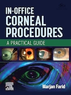 In-Office Corneal Procedures: A Practical Guide | رویه های قرنیه در مطب: راهنمای عملی