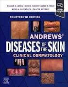 Andrews' Diseases of the Skin: Clinical Dermatology, 14th Edition | بیماری های پوست اندروز: درماتولوژی بالینی، ویرایش چهاردهم